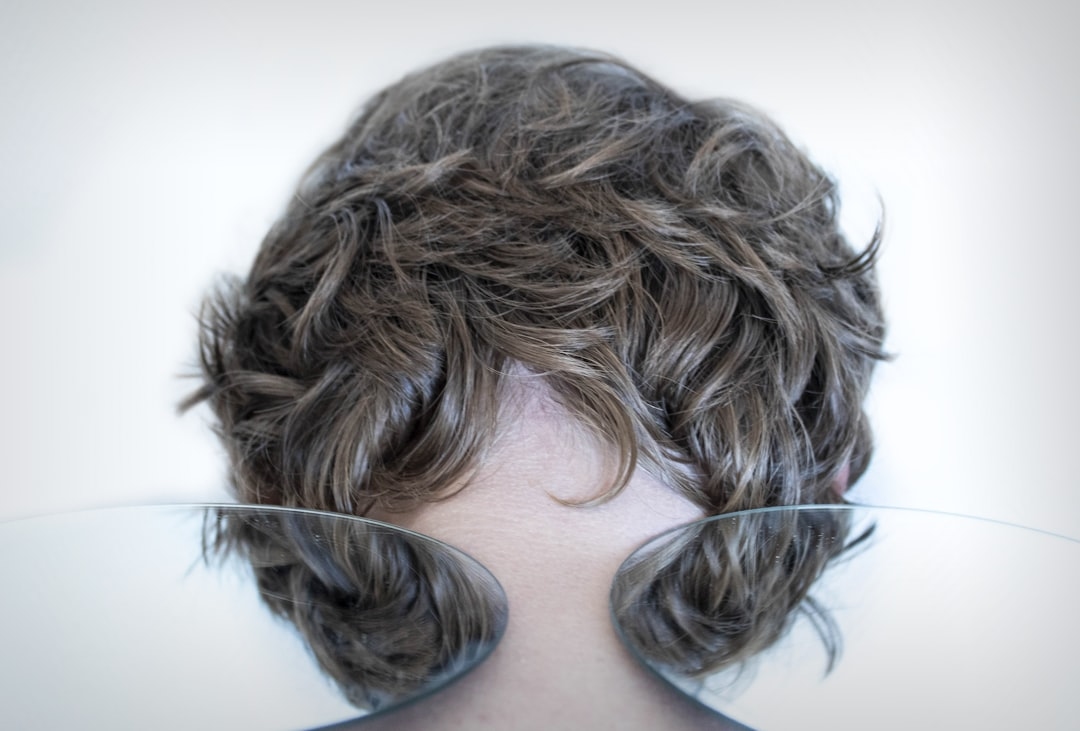 Why Do Moles Grow Hair? Biology and Treatment Options
