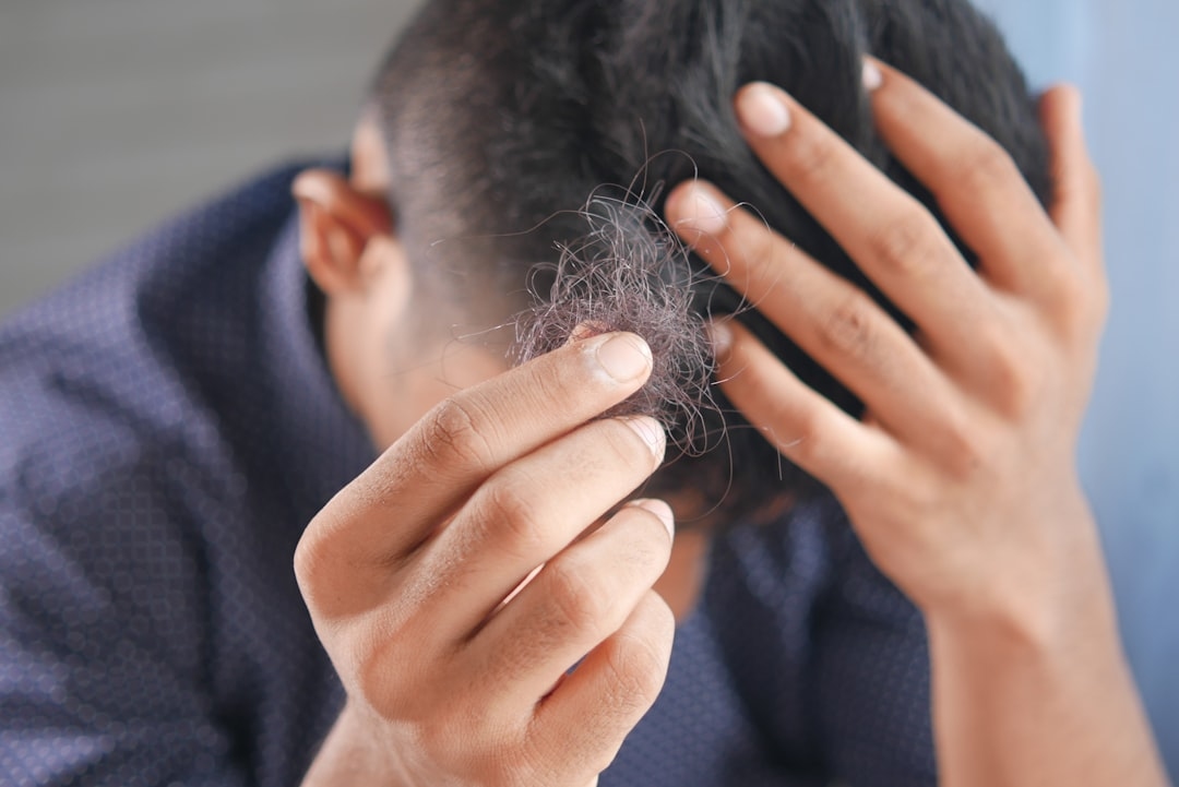 Does DHT Cause Hair Loss? Understanding the Science Behind Hair Thinning